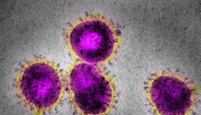 Coronavirus - Essential update for employers: “No room for complacency or panic”